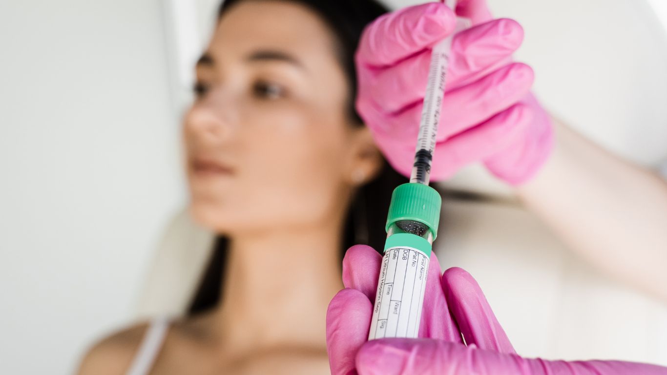 PRP in Dermatologia: un approccio innovativo per il trattamento della pelle