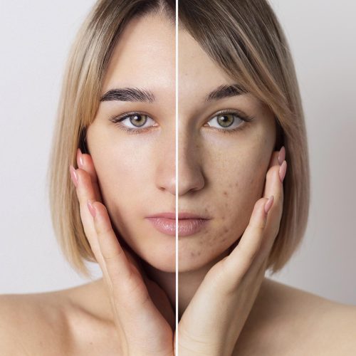 before-and-after-portrait-of-woman-retouched