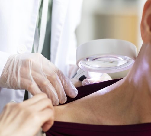 doctor-doing-a-check-on-a-patient-with-skin-cancer